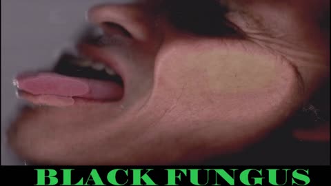 BLACK FUNGUS