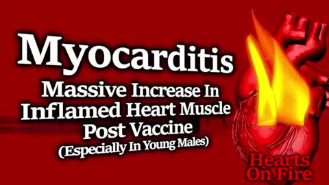 HEARTS IN FLAMES: NUMEROUS MYOCARDITIS STUDIES SHOWING EXTREME RISK FOR YOUNG MEN