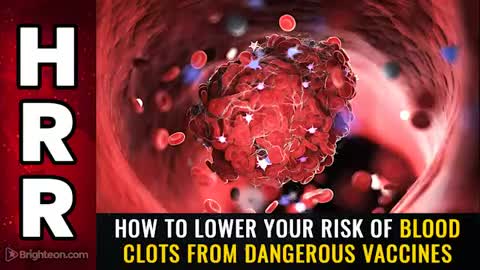04-16-21 - How to Lower Your Risk of BLOOD CLOTS From Dangerous Vaccines