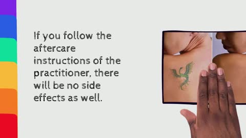 Can You Ever Fully Remove A Tattoo?