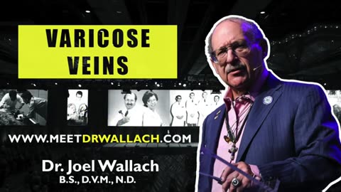 VARICOSE VEINS - DR. JOEL WALLACH