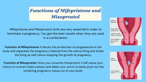 Difference Between Mifepristone and Misoprostol Pills