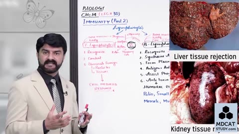 LEC#30 IMMUNITY (PART-B)