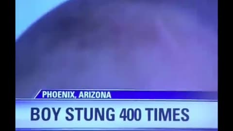 Bro just survive 400 bee stings 💀💀...