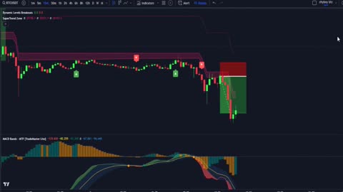 AI MACD INDICATOR: Best TradingView Indicator For Scalping