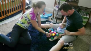 'Miracle Baby' Born Without Most of His Brain Defying Odds | ABC News