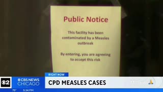 Chicago Police Department Buildings suffer an outbreak of Measles