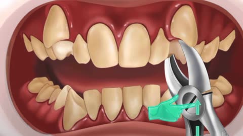 "Your Guide to Perfect Dental Care: An Animated Journey"