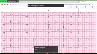 Pastest MRCP II Cardiology II