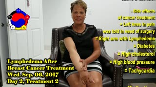 Testimonial on Lymphedema After Breast Cancer Treatment - Day 2, Treatment 2