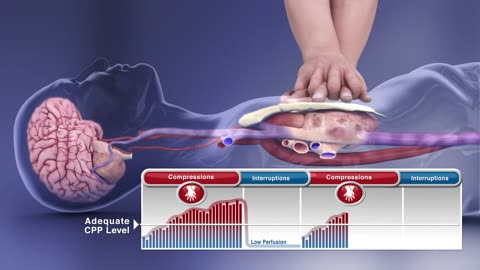 ACLS - 05 - High-Quality CPR Part 1