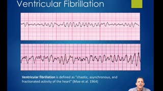 AEMT Ch 21 Cardiovascular Emergencies