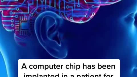 A computer chip has been implanted in a patient for the first time