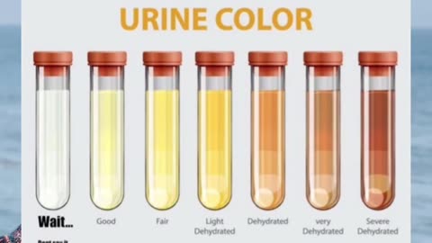 what is your urine color? #shorts