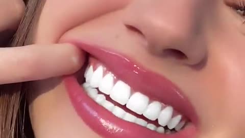 Beautiful Girl Cleaner Teeth Gone