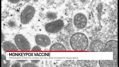 Providers stretching doses of monkeypox vaccine as students head back to college