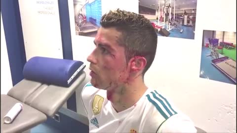 Cristiano Ronaldo injury 🤕🤕🤕