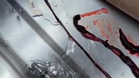 Unbelievable blood clots: video from embalmer Richard Hirschman