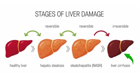 Fatty Liver Causes & Treatment