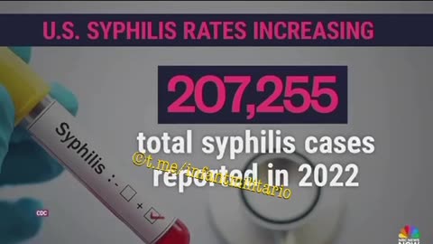 Meanwhile, syphilis is soaring in America