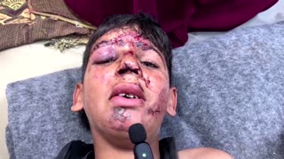 Wounded boy sobs recounting airstrike on Gaza school