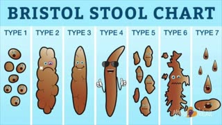What's your poo type?