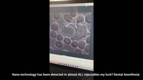 Blood Analysis of an Unvaccinated 50 Year Old Male Before & After Taking Daily CBDA & CBGA Hemp Oil