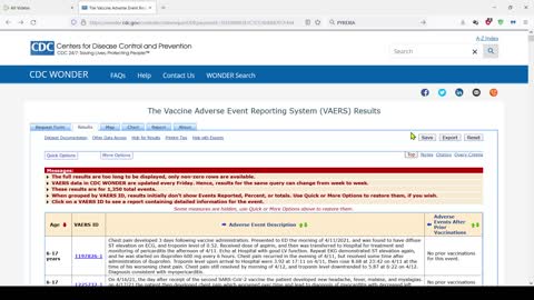 How to use the VAERS database for Myocarditis