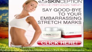 Skinception Intensive Stretch Mark Therapy reduces the appearance of stretch marks, smooth skin!