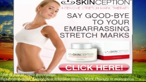 Skinception Intensive Stretch Mark Therapy reduces the appearance of stretch marks, smooth skin!