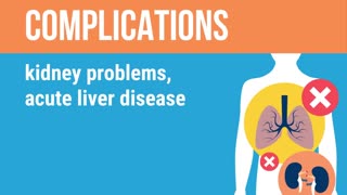 Know More About The Chlorine Dioxide The CDC and WHO Recommends