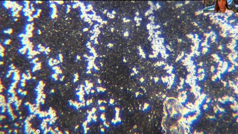 Darkfield Mikroscopy