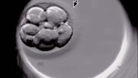 IVF: Only good potential embryos can reach the developmental stage.