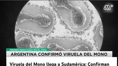Viruela del Mono llega a Sudamérica: Confirman caso en Argentina #news #noticias #nature #natural