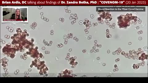 Doctor exposes blood to vaccine, reaction same as when exposed to snake venom