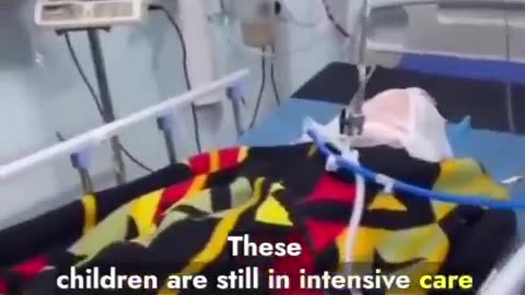 Gaza children are being burned alive in Israeli strikes