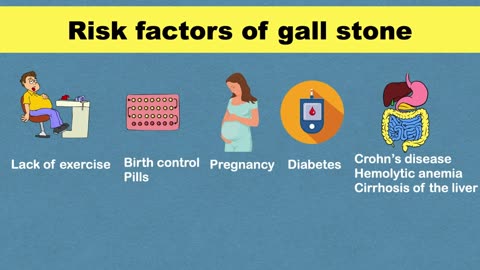 Decoding Gallbladder Stones Symptoms Unveiling Cholelithiasis and Gallstones Warning Signs