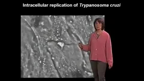 In Pzifer: parasite TRIPANOSAMA CRUZI, also found in HIV syndrome.
