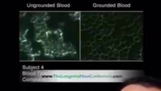 THIS IS WHATS HAPPENS TO YOUR BLOOD WHEN YOU TAKE YOUR SHOES OFF AND START GROUNDING TO EARTH