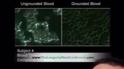 THIS IS WHATS HAPPENS TO YOUR BLOOD WHEN YOU TAKE YOUR SHOES OFF AND START GROUNDING TO EARTH