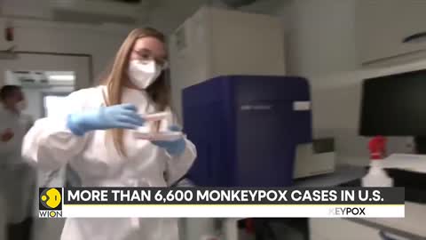 United States declares Monkeypox outbreak a health emergency | Latest World News |