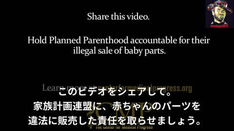 覆面調査_全米家族計画連盟（PPFA）が中絶胎児の臓器を売買（2015年動画）