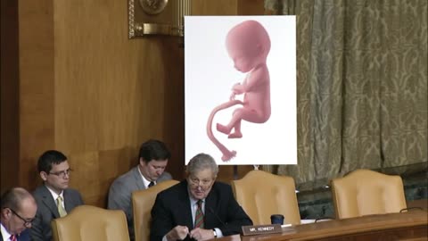 Witness Confirms the Abortion Procedure IS BARBARIC