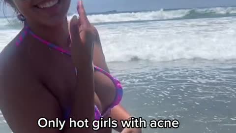 Only hot girls with acne understand