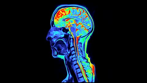 Colored sagittal #MRI scans of a normal healthy head and neck.