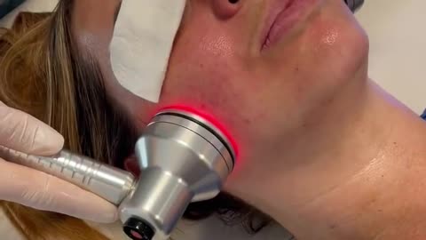 HydraFacial Vortex Fusion Facial