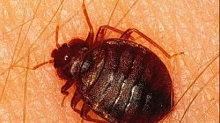 PrankNET- Jeri Notifies Hillbillies of the Hotel's Bed Bug Problem P1/2 - pranknet archive