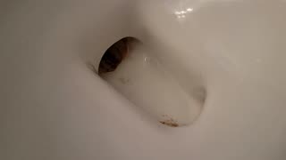 How to get rid of the buildup in your toilet