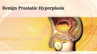 Benign Prostatic Hyperplasia