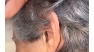 Spider Comes out of Woman's Ear